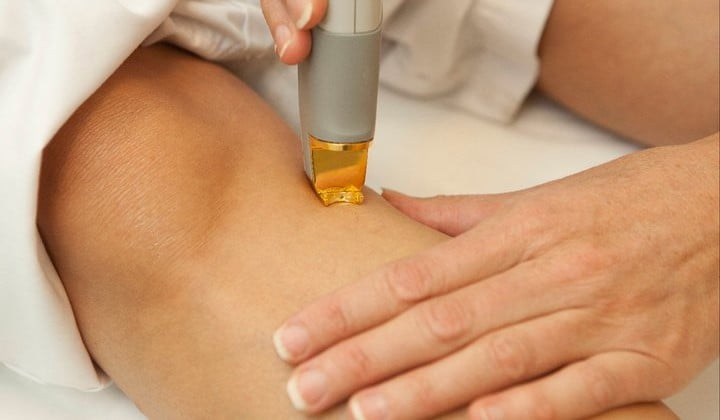 YAG-laserbehandling av sprengte blodkar