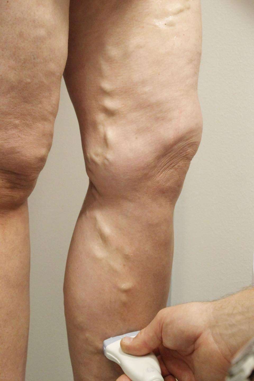 Ultralyd av åreknuter